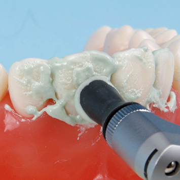 SRP用顎模型 [D18FE-500H(GUB)-MF](FE咬合器つき)｜株式会社ニッシン