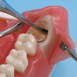 口腔外科実習用顎模型 [P15FE-OOP.1](FE咬合器つき)｜株式会社ニッシン