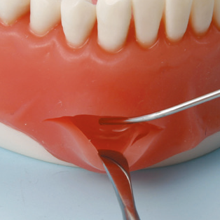 口腔外科実習用顎模型 [P15FE-OOP.1](FE咬合器つき)｜株式会社ニッシン