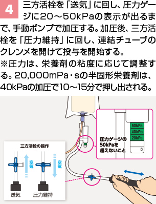 PG加圧バッグⅢ | PG加圧バッグⅢ | ニュートリー株式会社