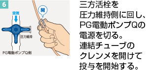 PG加圧Qシリーズ（PG電動ポンプQ、PG加圧バッグQ） | PG加圧Qシリーズ