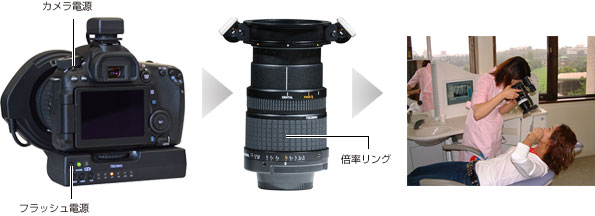 リングフラッシュシステム