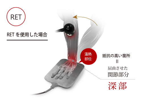 フィジオ ラジオスティム プロ | 酒井医療株式会社