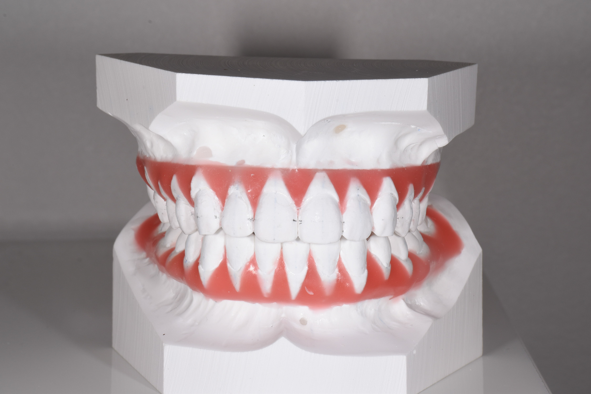 矯正治療のセットアップ模型とは？？｜Doctor Blog｜名古屋市緑区の