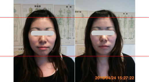 小顔矯正で左右差解消｜大阪・奈良・神戸・心月整体院（女性専用サロン）