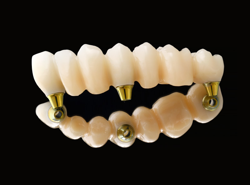 CAD / CAM補綴 -松風バイオフィックス-