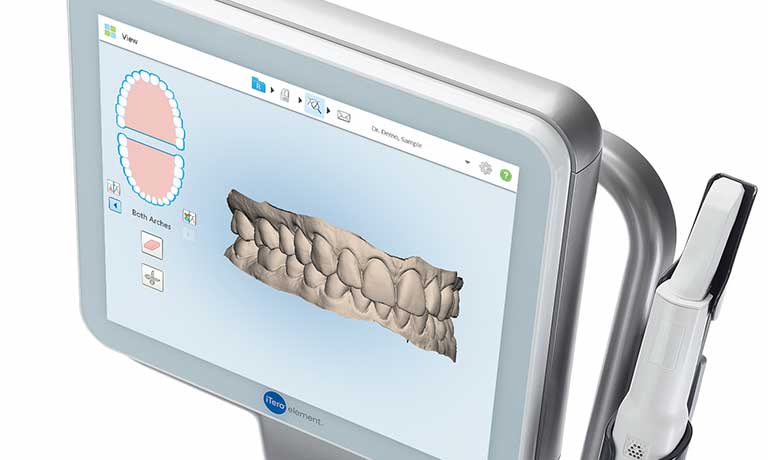 口腔内スキャナー iTero® element | 庄野歯科 北浜オフィス