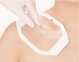 エアウォールIV｜製品ページ｜skinix（スキニックス）