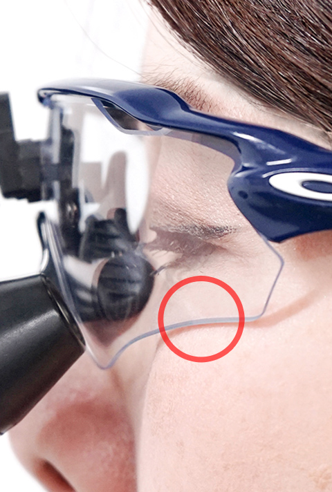 FINE LENS｜Surgitel～拡大鏡サージテル～歯科専用サイト