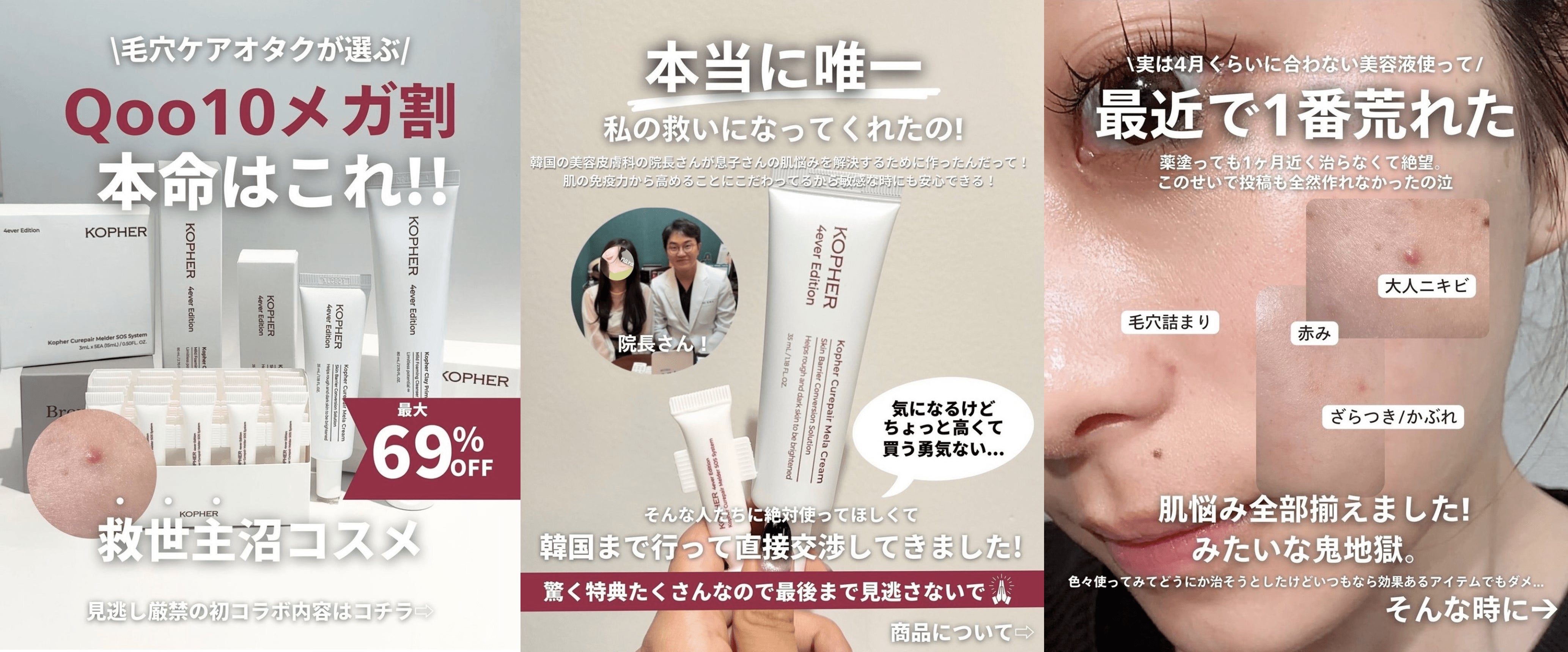 売上2,800万円を記録！ 韓国スキンケアブランド「KOPHER（コフェル