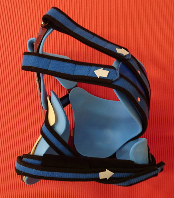 選ばれる理由｜オリジナル子ども用義肢｜株式会社プレーリーファクトリー