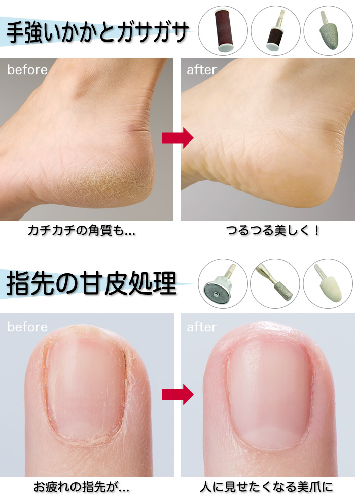 楽天市場】*TVや雑誌でも注目！フットケア の本格派マシン マニ