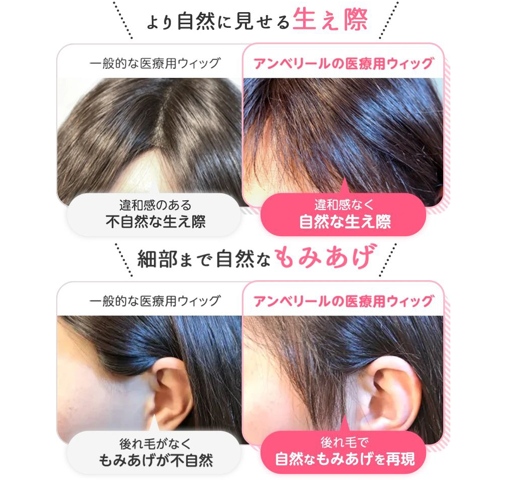 楽天市場】【 医療用ウィッグ 人気】【自宅でお試し無料試着