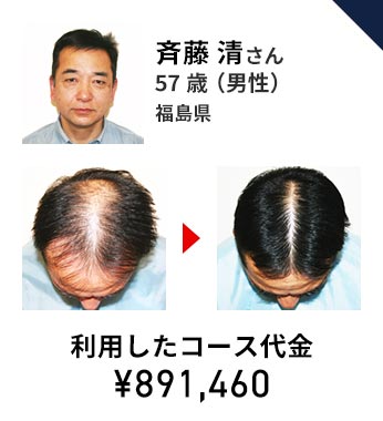 リーブ21の料金大公開！ | 薄毛対策・発毛専門のリーブ21