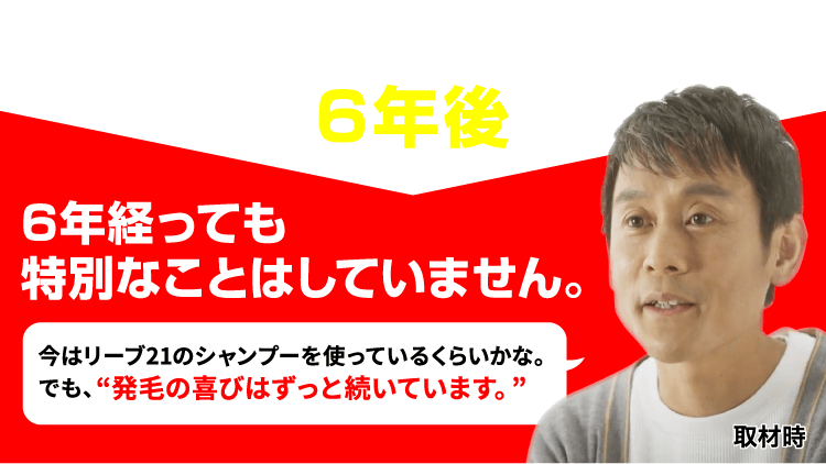 薄毛改善・発毛専門リーブ21 85.28%のお客様の抜け毛が減少 実感できる