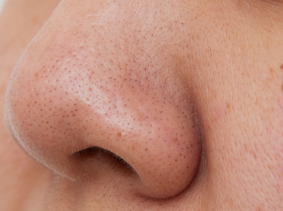 ハイドラフェイシャル｜リゼの美肌治療