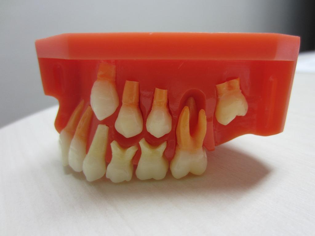 設備紹介）説明用模型 乳歯生え変わり！｜柏市の歯医者 ウィズ歯科