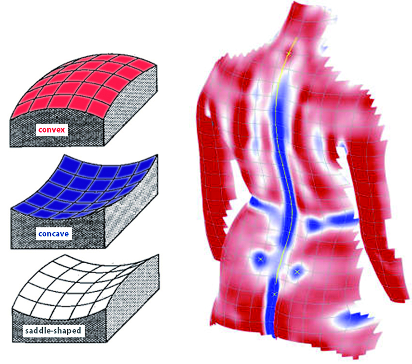 DIERS 4D Lab 姿勢・動的解析システム｜姿勢・動的解析システム｜医療
