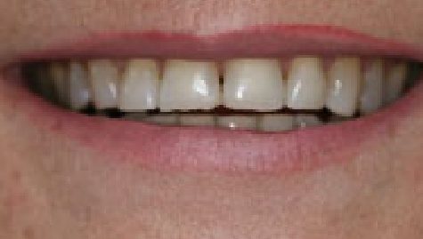 Smile Gallery Houston, TX | Terri Alani, DDS