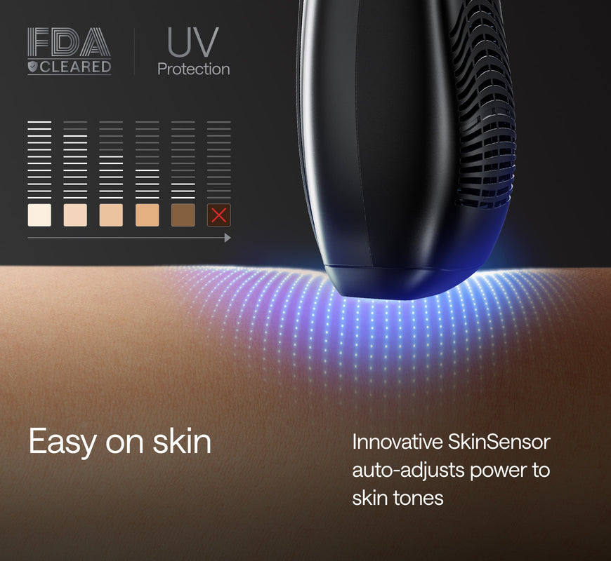 Ulike X IPL for Men: IPL Hair Removal Device