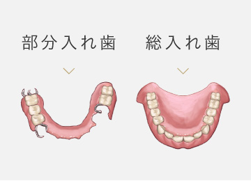 義歯（入れ歯） | 診療案内 | 神奈川区の歯医者 横浜駅きた西口歯科
