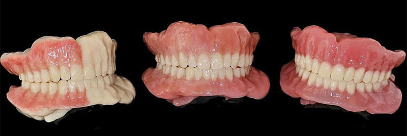 義歯（入れ歯）のご相談は射水市の歯科「やまざき歯科医院」