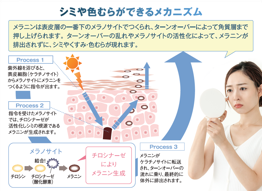 インナップEX モイスチャーローション モア MD｜スキンケア・メイク