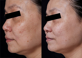 ZX-CLINIC【公式】｜大阪梅田・北新地からすぐの安くて承認機使用の