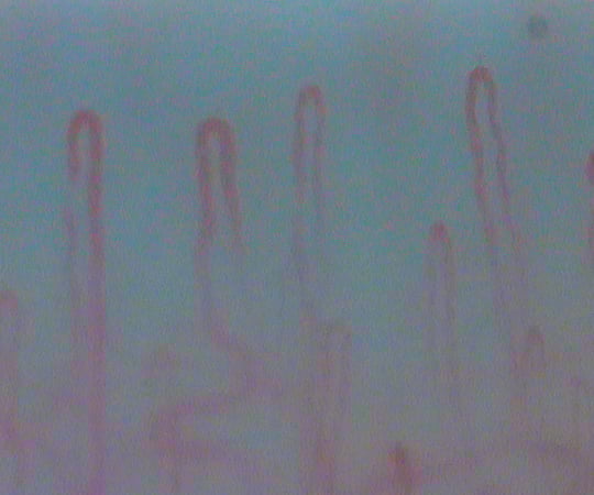 7-7904-01 毛細血管スコープ（血管美人） SC-10 【AXEL】 アズワン