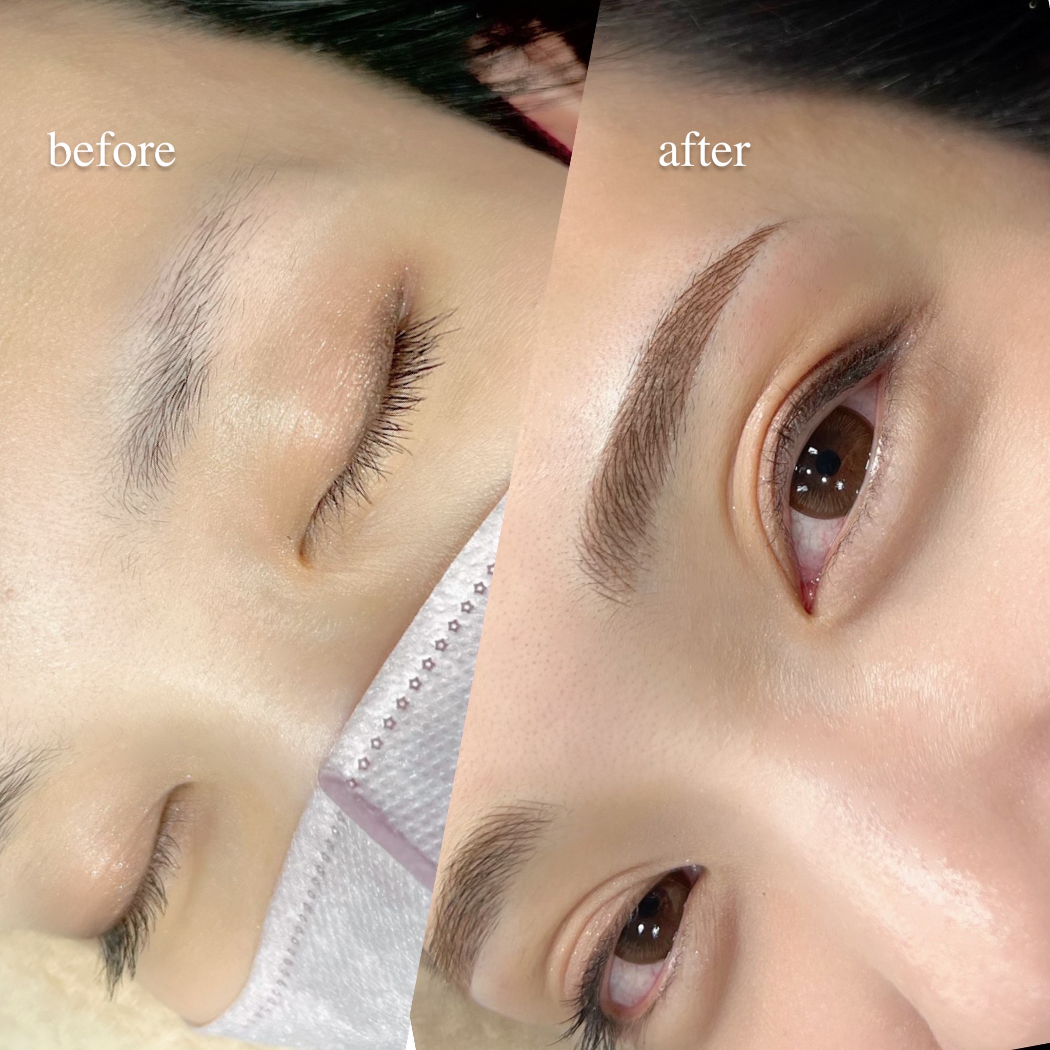 医療アートメイク - 芦屋ファミリークリニック形成外科皮フ科