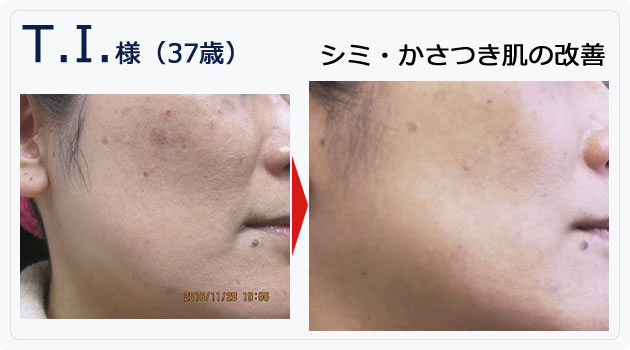 ベルスフリールとは - ASEAN Pacific Cosmetics