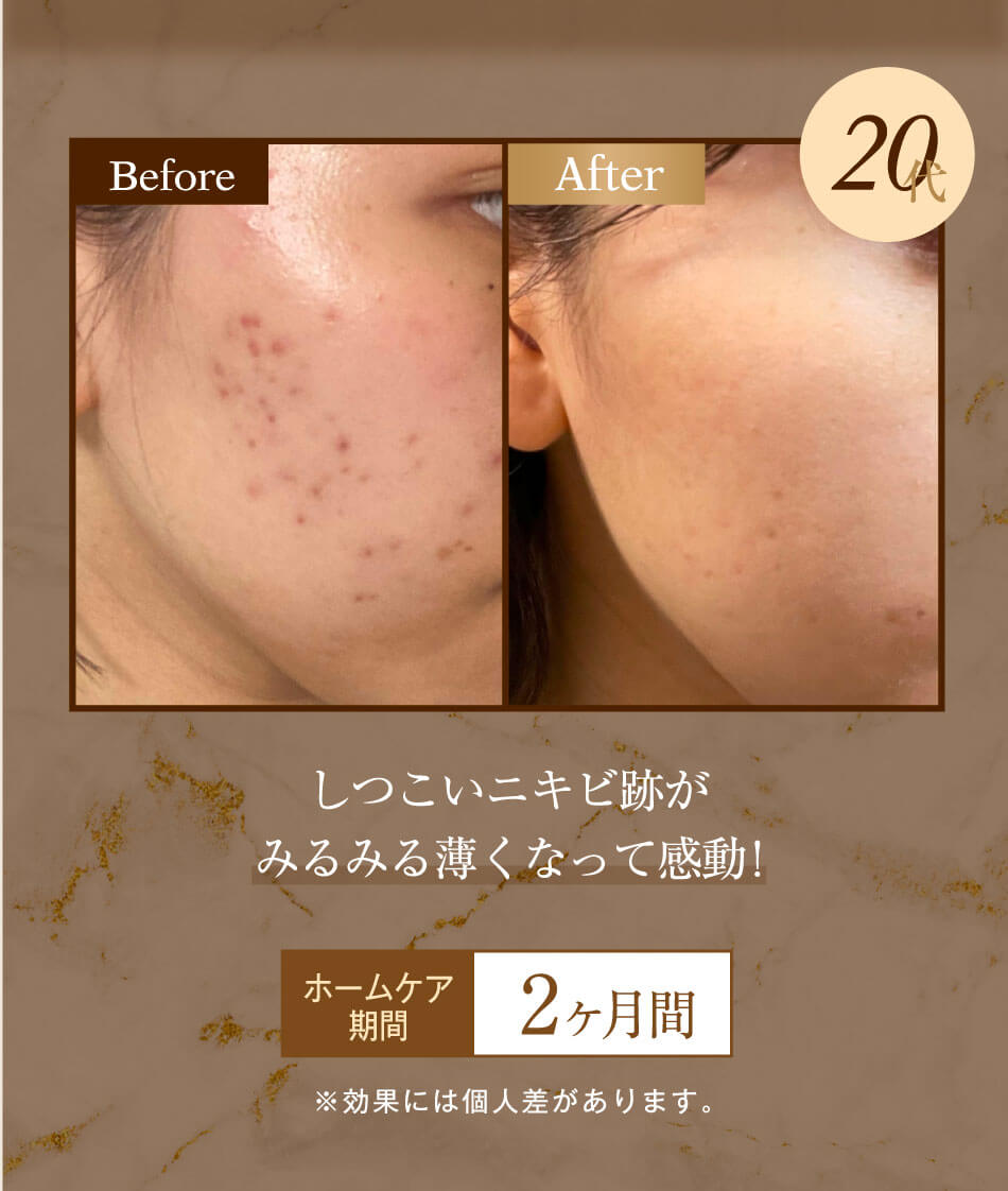 プラチナシリーズ化粧品|Platina Series|アフロスクィーン