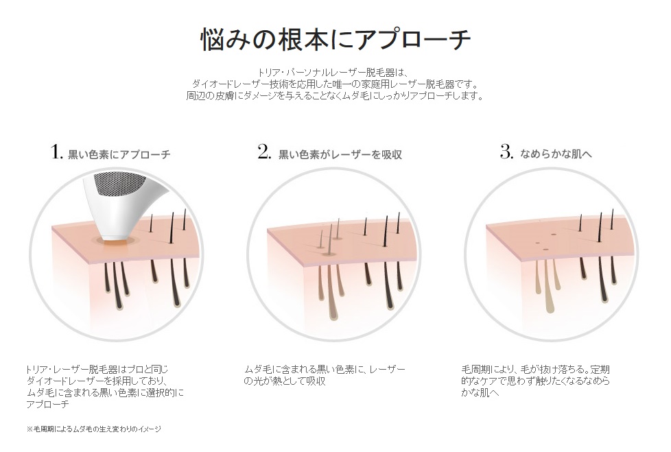 トリアビューティー トリア・パーソナルレーザー脱毛器 4X-美容機器の