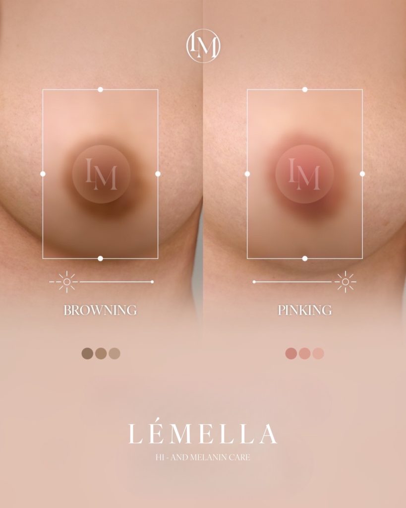 LÉMELLA-ルメラ- Beige beauty | ベイジ ビューティ