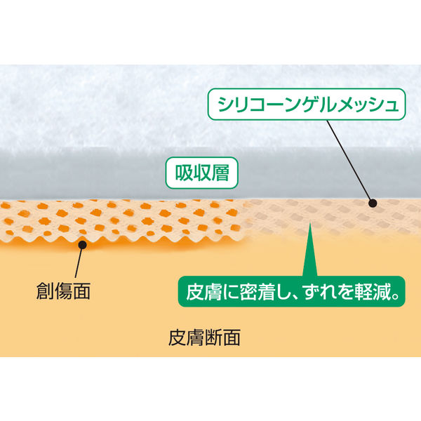 アルケア エスアイエイド 7号（10×20cm） 18753 1箱（30枚入） - アスクル