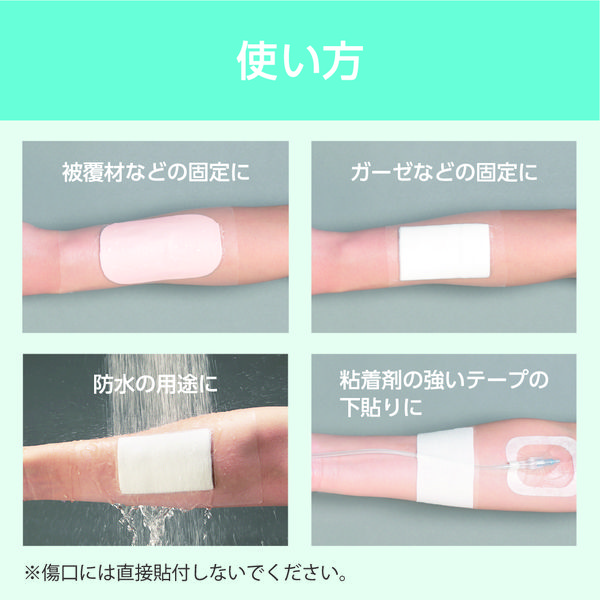 ニトムズ 優肌パーミロール Lite L34R05 1巻 フィルムドレッシング