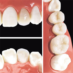 FEEDデンタル】歯科模型/患者説明用品の通販｜歯科医院向け材料・用品