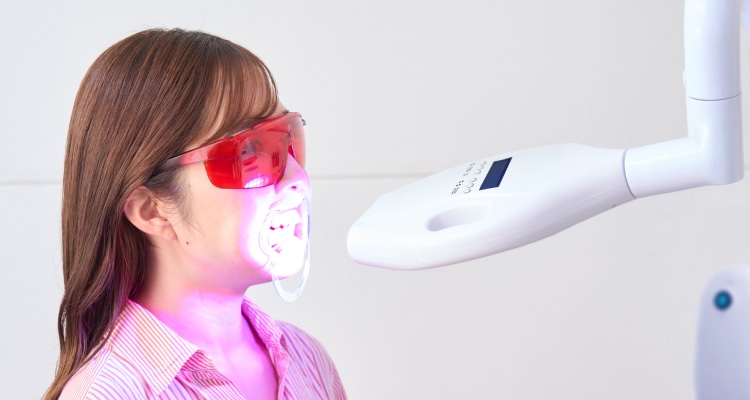 セルフホワイトニング｜チョコザップ｜24時間使えるコンビニジム