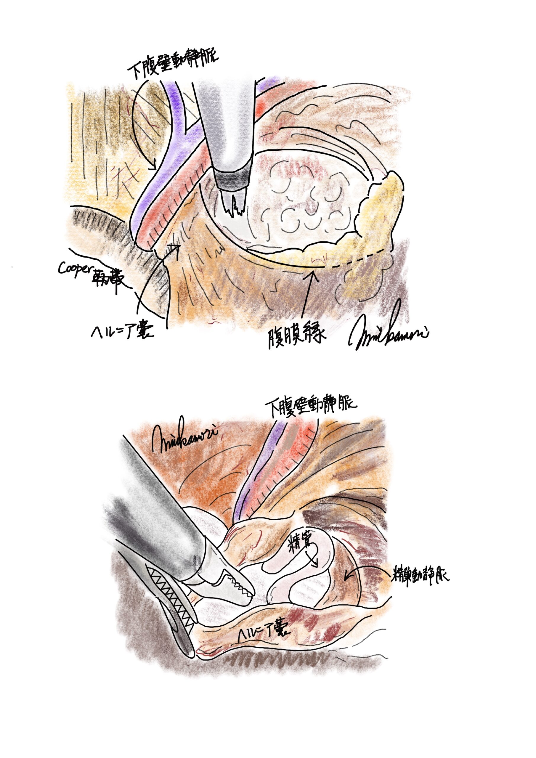外科医の手術記録（オペレコ）とは？ - 西宮敬愛会病院 COKU 鼠径