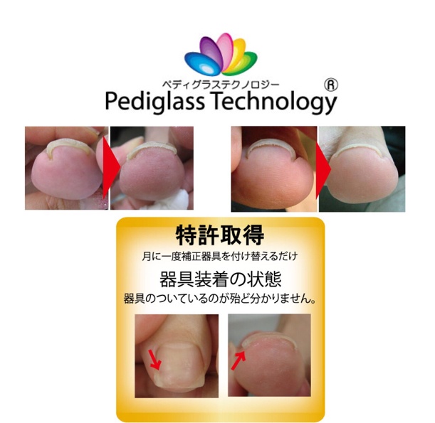 IMP/ペディグラス/左ニューパワーフリースタイル IMP/ペディグラス/左