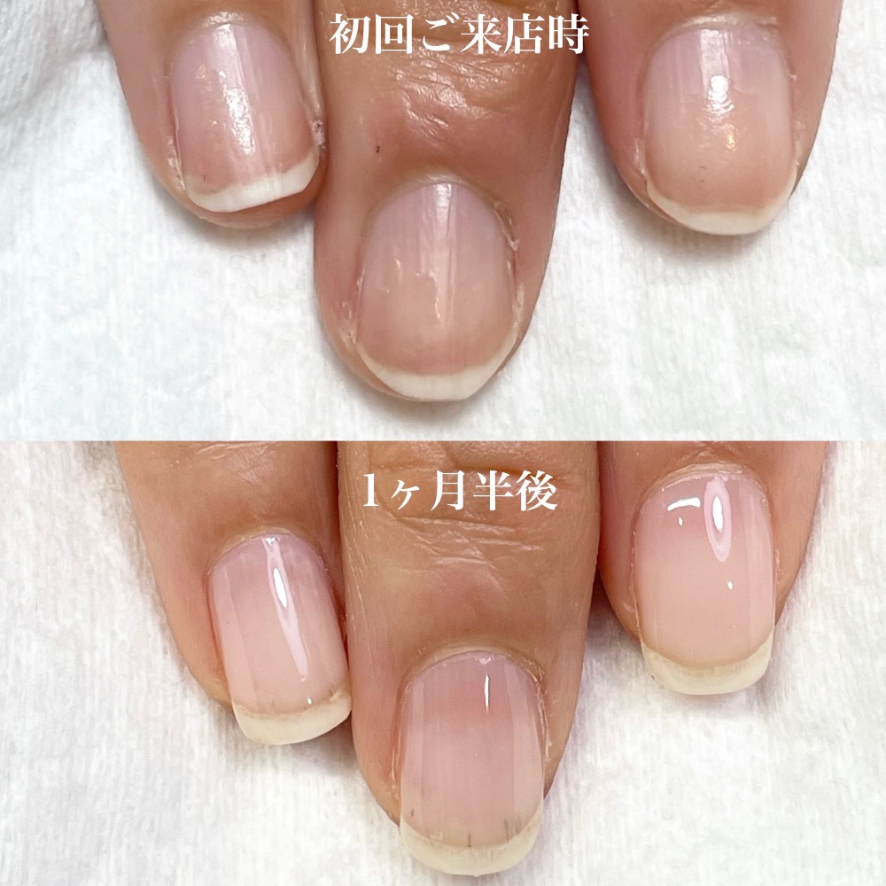 ネイルってこんなに我慢しないといけないの？！と思っていたお客さまが