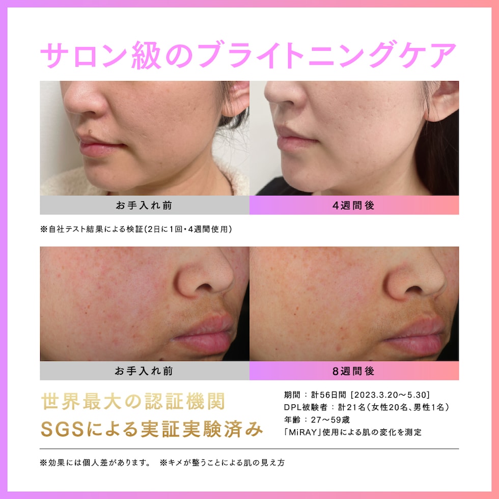 dショッピング |効果検証済 脱毛器 ムダ毛ケア [公式] MYTREX MiRAY