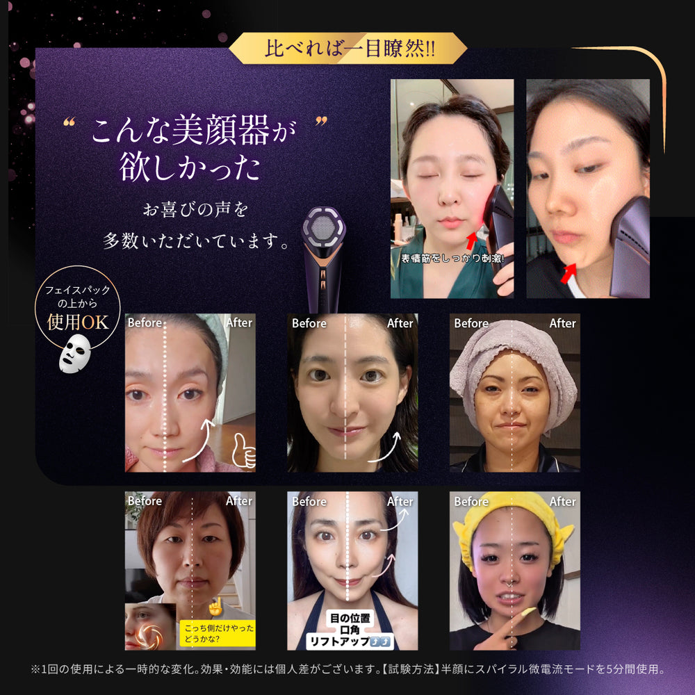 NOWMI LAB スパイラルケア美顔器STORM – アーリーバード オンライン