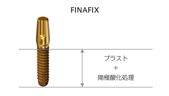 日本『京セラ（KYOCERA）』インプラント | 埼玉県狭山市 インプラント