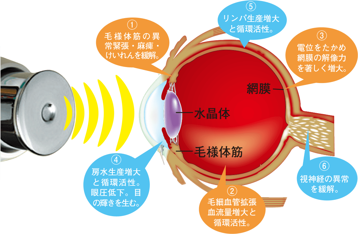 視力改善治療機器 F-SONIC フタワソニック 特設サイト | 厚生労働省