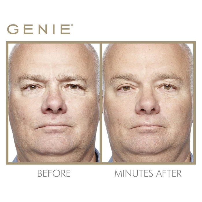 Instant Line Smoother, 19ml & 30ml – Genie Beauty Products