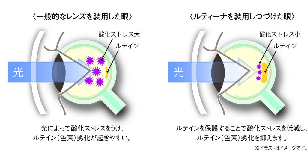 アイケアレンズ | MEGANE MUSEUM | めがねミュージアム