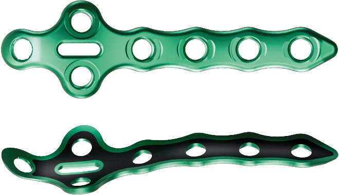 Apollo AFX™ Ankle Fracture Plating System - GLW Medical