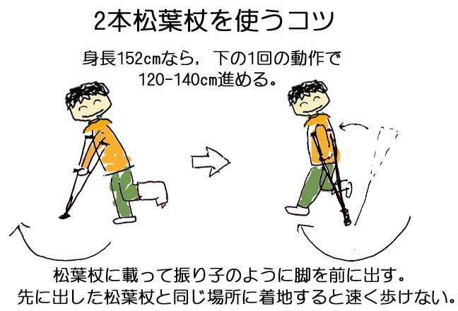 カナダ脚；iWalkfree 2.0（ニークラッチ：アイウォークフリー）