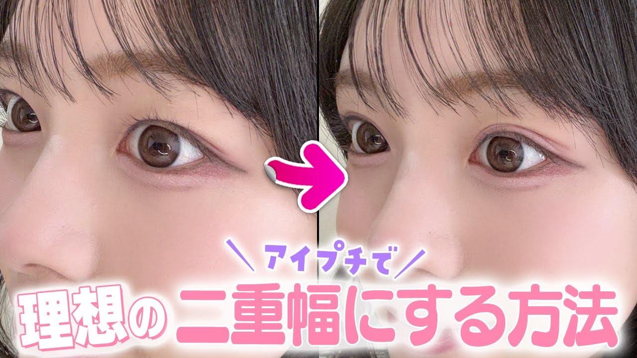 Introducing how to create the perfect double eyelids using eyelid
